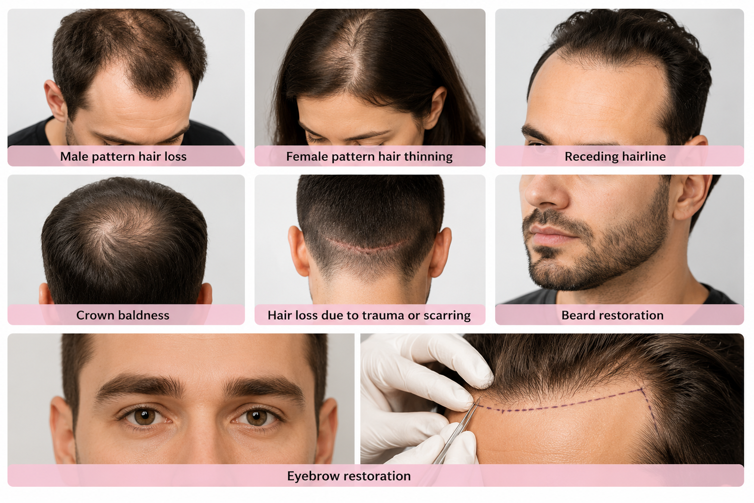 Medical team performing hair scalp assessment